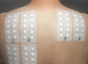 Module 1: Introduction to Patch Testing